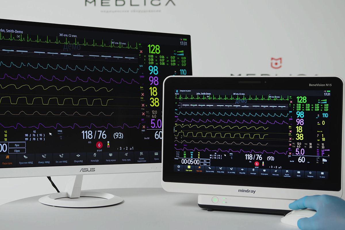 Модули и каналы измерения в мониторах пациента Mindray BeneVision N-серии