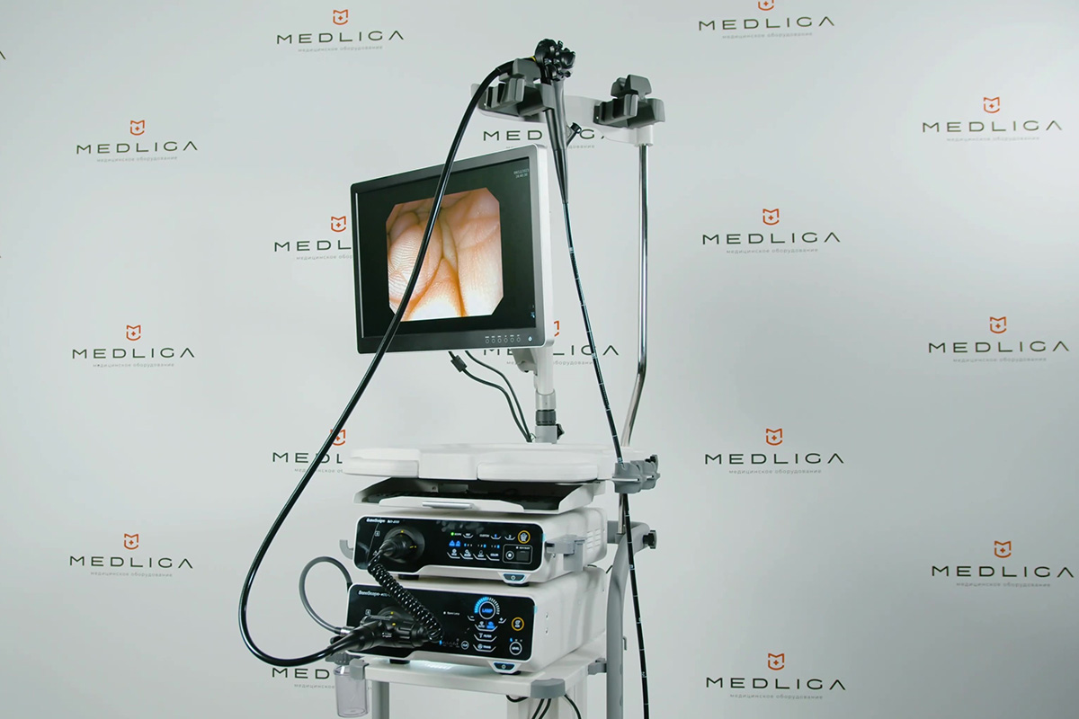 Обзор эндоскопической системы Sonoscape HD-500