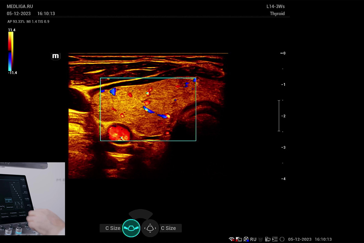 Оптимизация изображения во время исследования щитовидной железы