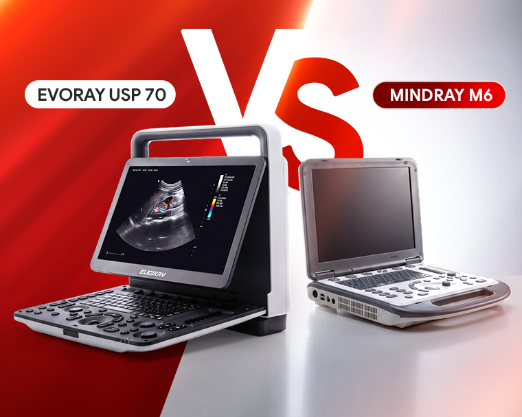 EVORAY USP 70 или Mindray M6: сравнение портативных УЗИ-аппаратов